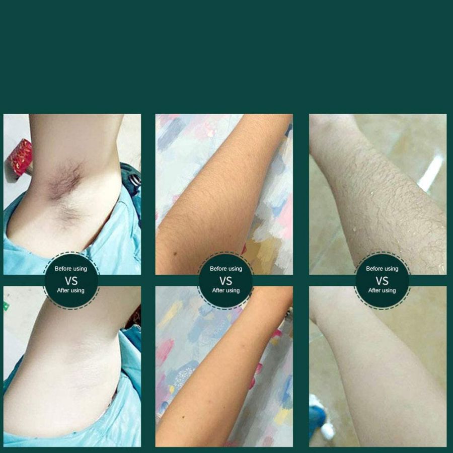 Permanent Hair Remover System 400000 Flashes Hair Removal Device